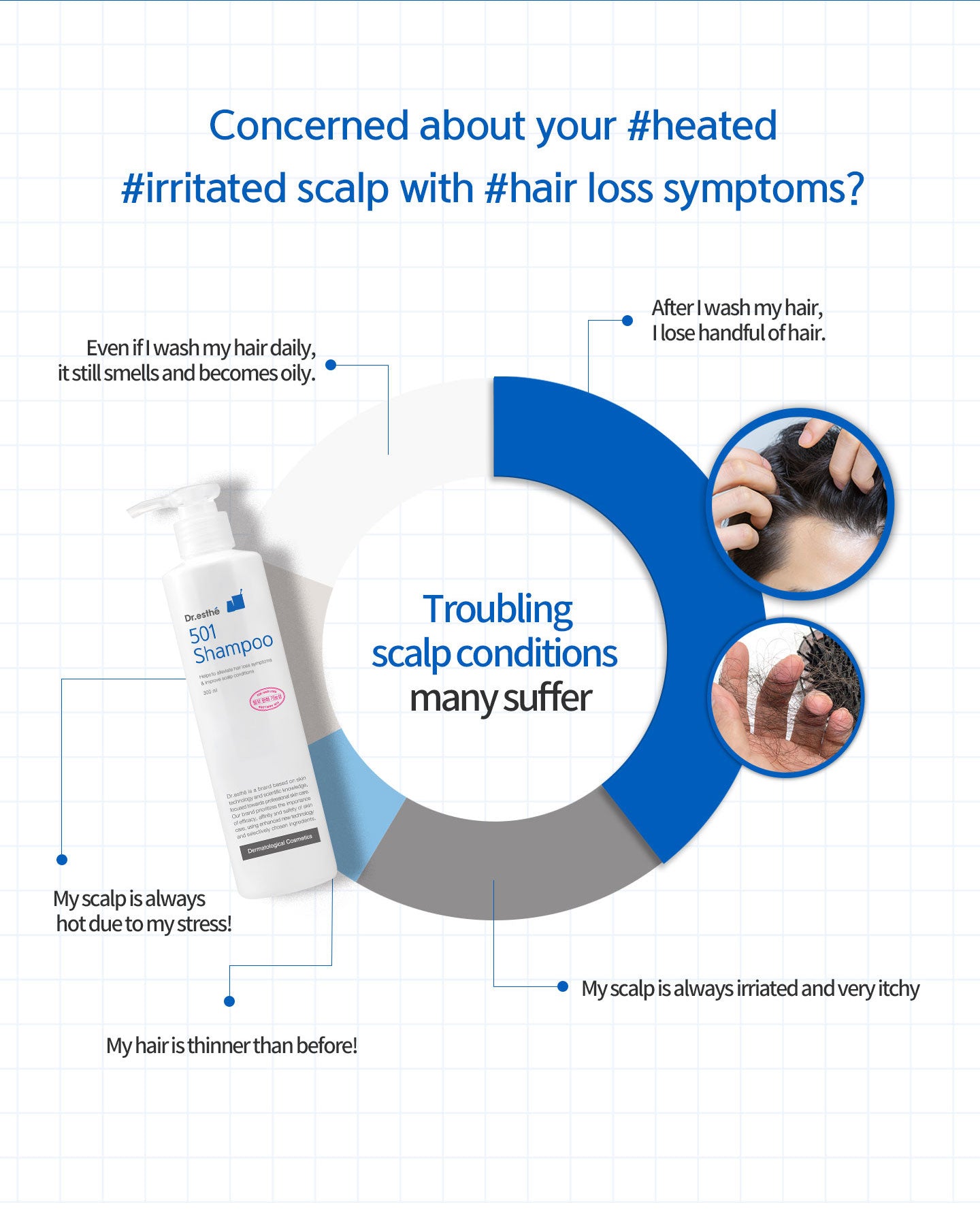 Troubling scalp conditions many suffer: My scalp is always irritated and very itchy. Even if I wash my hair daily, it still smells and becomes oily. After I wash my hair I lost handful of hair. My scalp is always hot due to my stress. My hair is thinner t