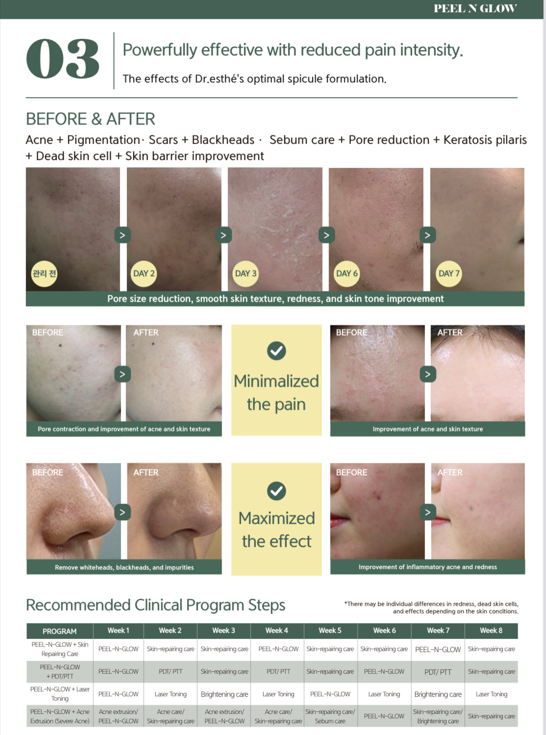 PEEL N GLOW Pearl program kit