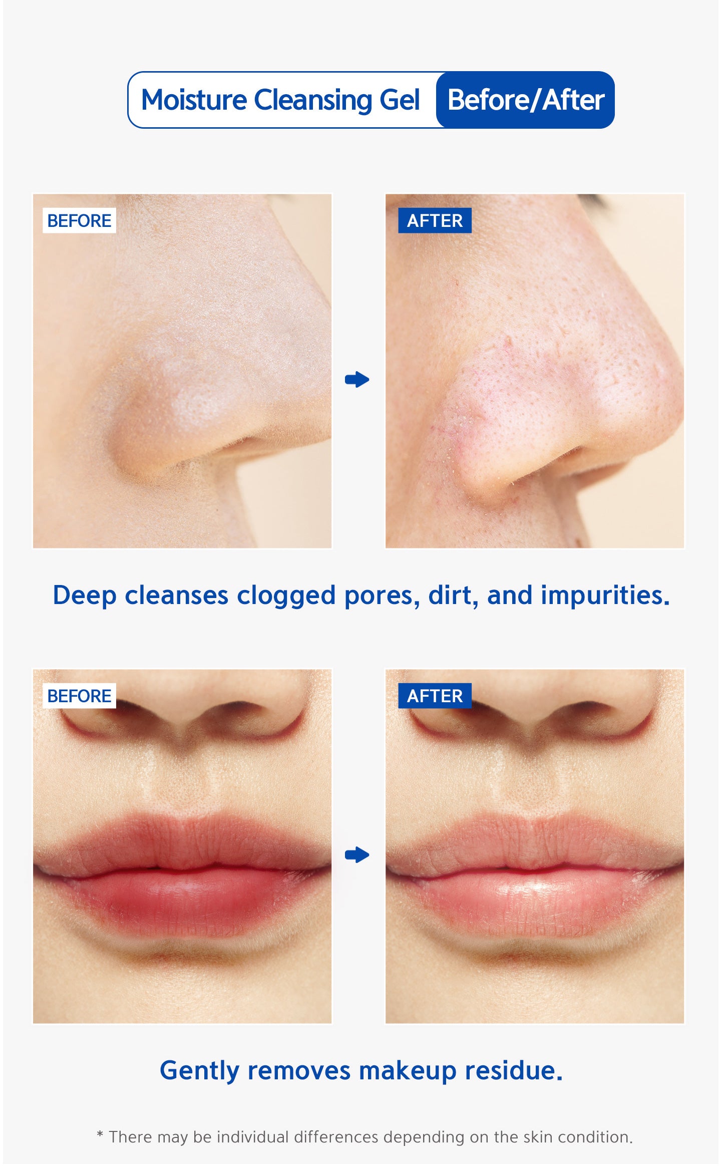 Deep cleanses clogged pores, dirt, and impurities. Gently removes makeup residue.