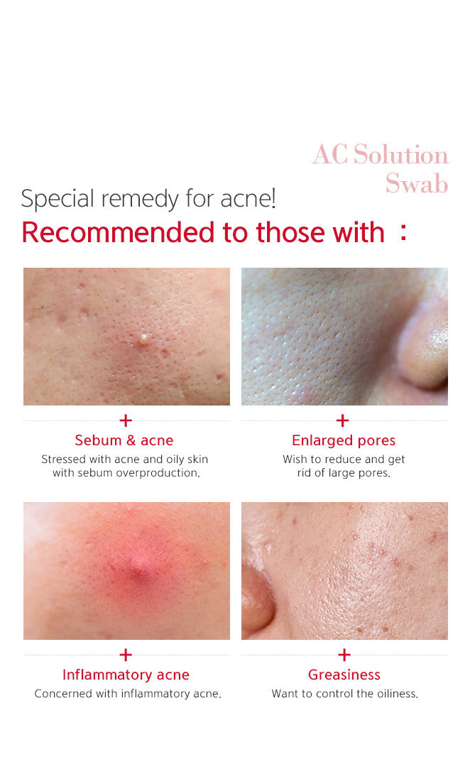 Special remedy for acne! Recommended to those with sebum & acne, enlarged pores, inflammatory acne, and greasiness. 