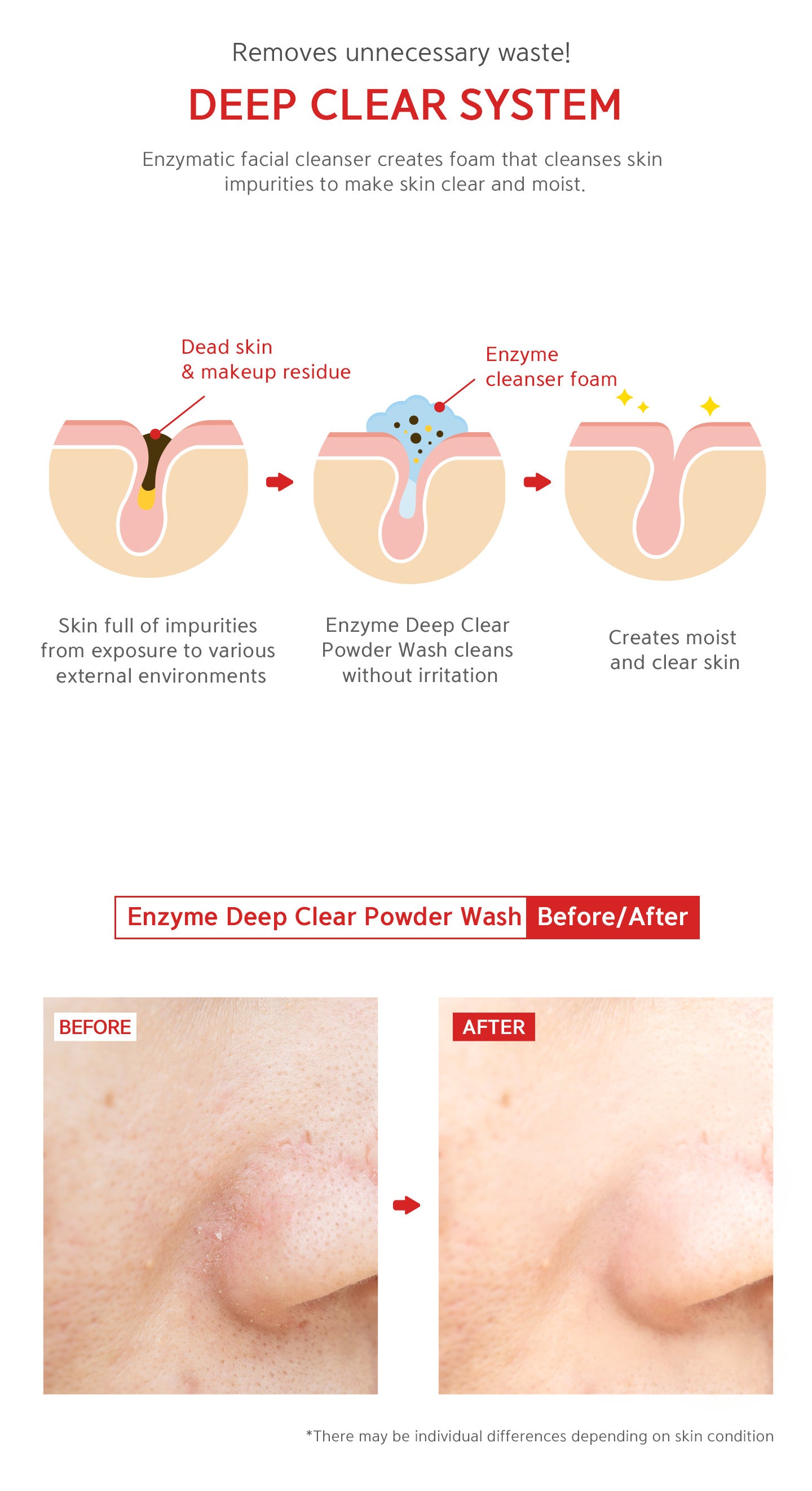 Deep clear system removes unnecessary waste. Enzymatic facial cleanser creates foam that cleansers skin impurities to make skin clear and moist. 